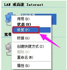 本地连接受限制,知识兔小编告诉你如何修复电脑接受限制