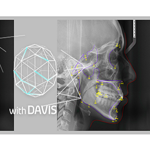 eZOrtho For Smart3D v20 for AutoCAD 2020破解版下载