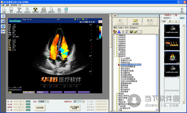 超声工作站软件