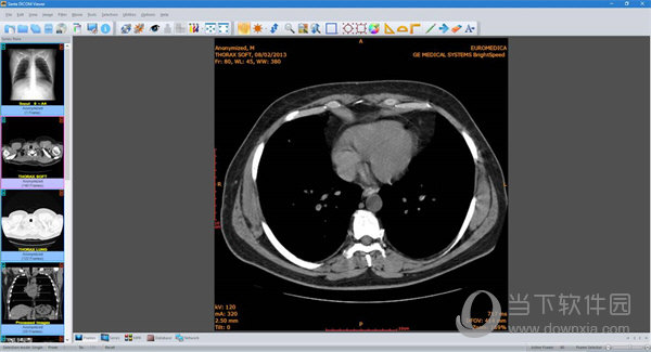 RadiAnt DICOM Viewer