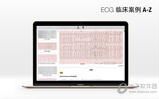 ECG A-Z Pro